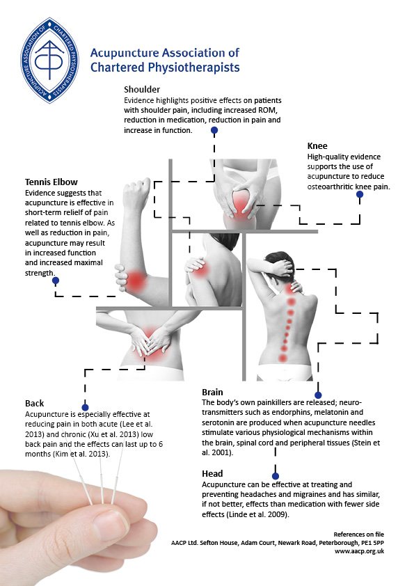 AACP_Physio's tweet image. It might surprise you how many conditions #acupuncture can help manage.

From #migraines to #tenniselbow, there is a growing body of scientific research to support its effects.