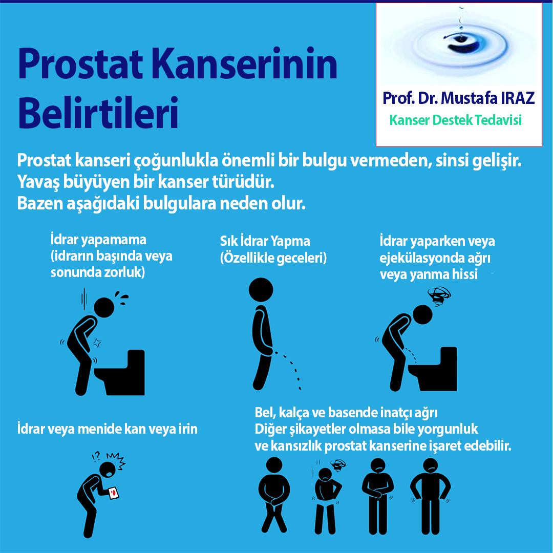 Prostat Kanseri Belirtileri Nelerdir? 
Bu belirtiler sizde de varsa alanında uzman bir hekime başvurunuz.