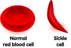 Dorktrooper1's tweet photo. Did you know that having the sickle cell disease means that both of your parents have the sickle cell gene? You could have the trait by one of your parents having the gene.#RHSBMS https://t.co/MSYzAUzqxm