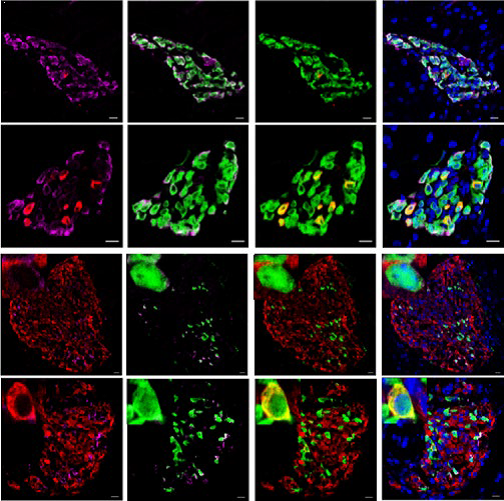 A recent <a href="/JDRFresearch/">JDRF Research</a> funded study showed alpha and delta cells have been known to spontaneously engage in insulin production when beta cells are lost. What does that mean for the future of T1D? Find out: ow.ly/V5VT30mGV8p #DiaBasics