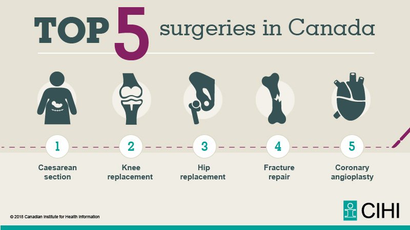 Top 5 surgeries in Canada: #Csection, #kneereplacement, hip replacement, fracture repair and coronary artery angioplasty.ow.ly/LXIH30jDw1v