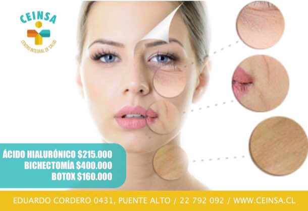 ceinsa (@ceinsa) on Twitter photo 