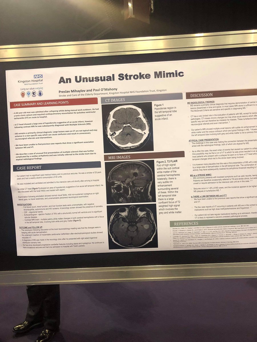 StrokeUlht's tweet photo. We’re @UKStrokeForum this week, lots of new ideas to help develop our stroke service. @LCHStrokeUnit @ULHT_News #stroke #Strokecare #acutestrokecare #patientcenteredcare #safecare #strokerecovery https://t.co/50UzBqY5jV