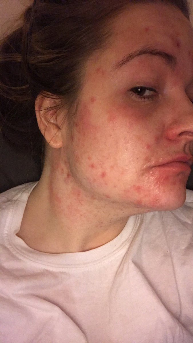 Rachel Chew tweet media