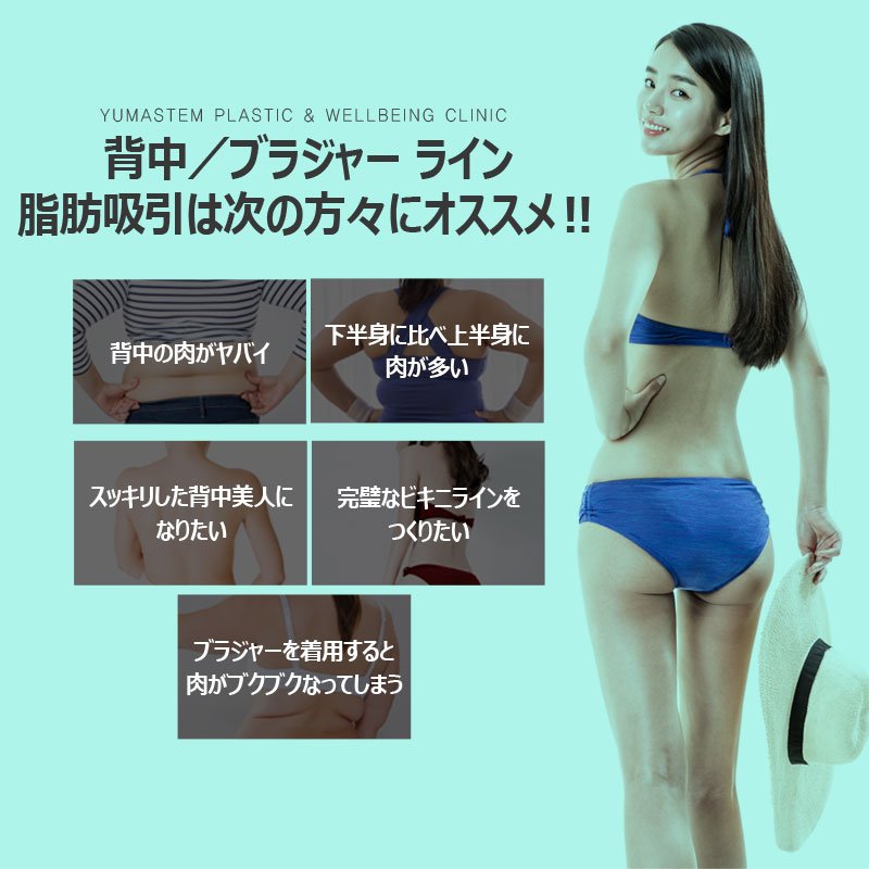 清潭ユマステム美容外科 金浦に移転予定 背中の肉 落とし方 落としにくい上半身は 脂肪吸引で T Co Dz4vgzdqtx 韓国留学 ソウル 韓国美容外科 韓国整形外科 整形 美容 脂肪溶解注射 ミニv Vライン形成 童顔 美容整形 脂肪分解