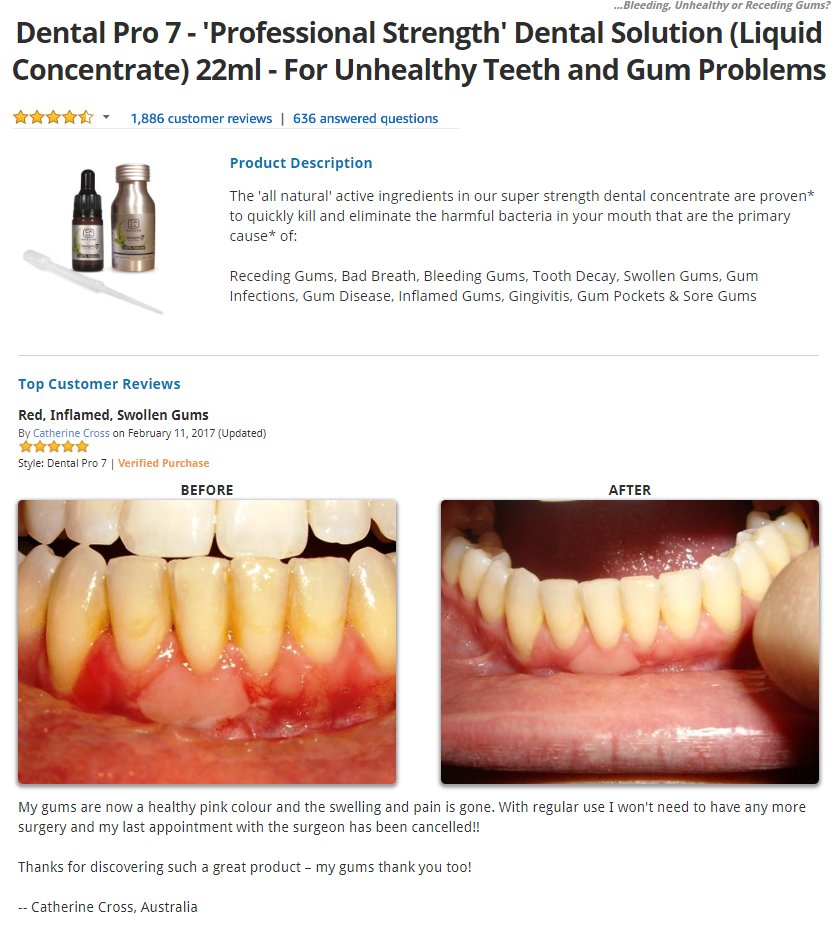 THENervousNick's tweet photo. Dental Pro 7 - Dental Pro 7 - 'Professional Strength' Dental Solution (Liquid Concentrate) 22ml - For Unhealthy Teeth and Gum Problems
https://t.co/kgkY9hVwfk https://t.co/ypLB4NwpY0