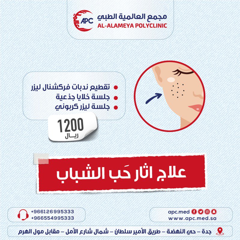 وداعا لاثار حب الشباب مع مجمع العالمية الطبي
*تقطيع ندبات فركشنال ليزر
*جلسة خلايا جذعية
*جلسة ليزر كربوني كل هذا ب1200ريال
العنوان/حي النهضة شارع الامير سلطان شمال شارع الامل مقابل مول الهرم
لمزيد من الاستفسار 0554995333
#وش_وظيفتك_في_الحياه