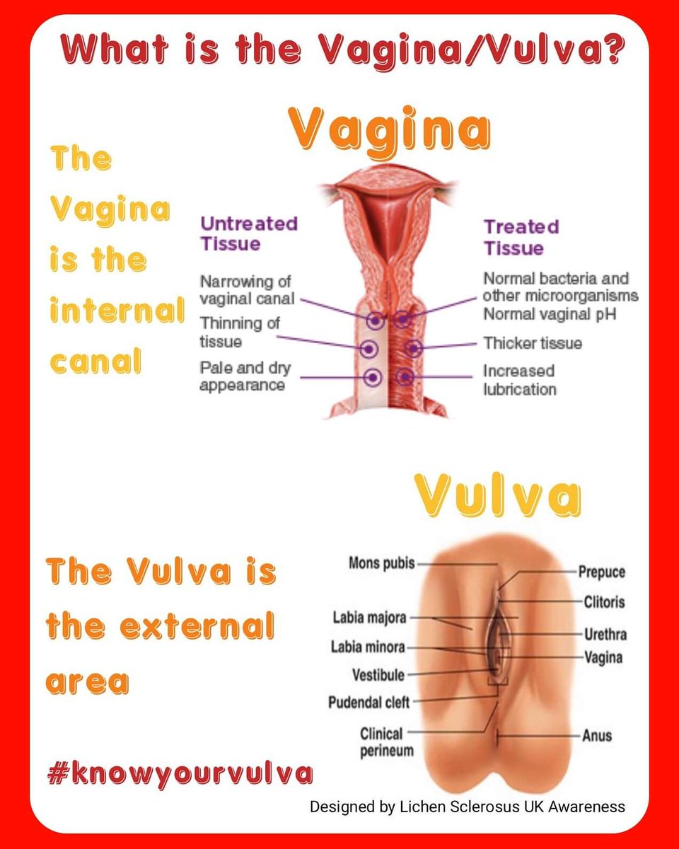 What Is A Vaginal Sling.