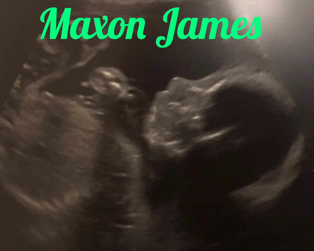ty042490's tweet photo. #babyfunk #babymax #boymom #funkybunch @Matthew_Funk https://t.co/wR8tLs7fCB