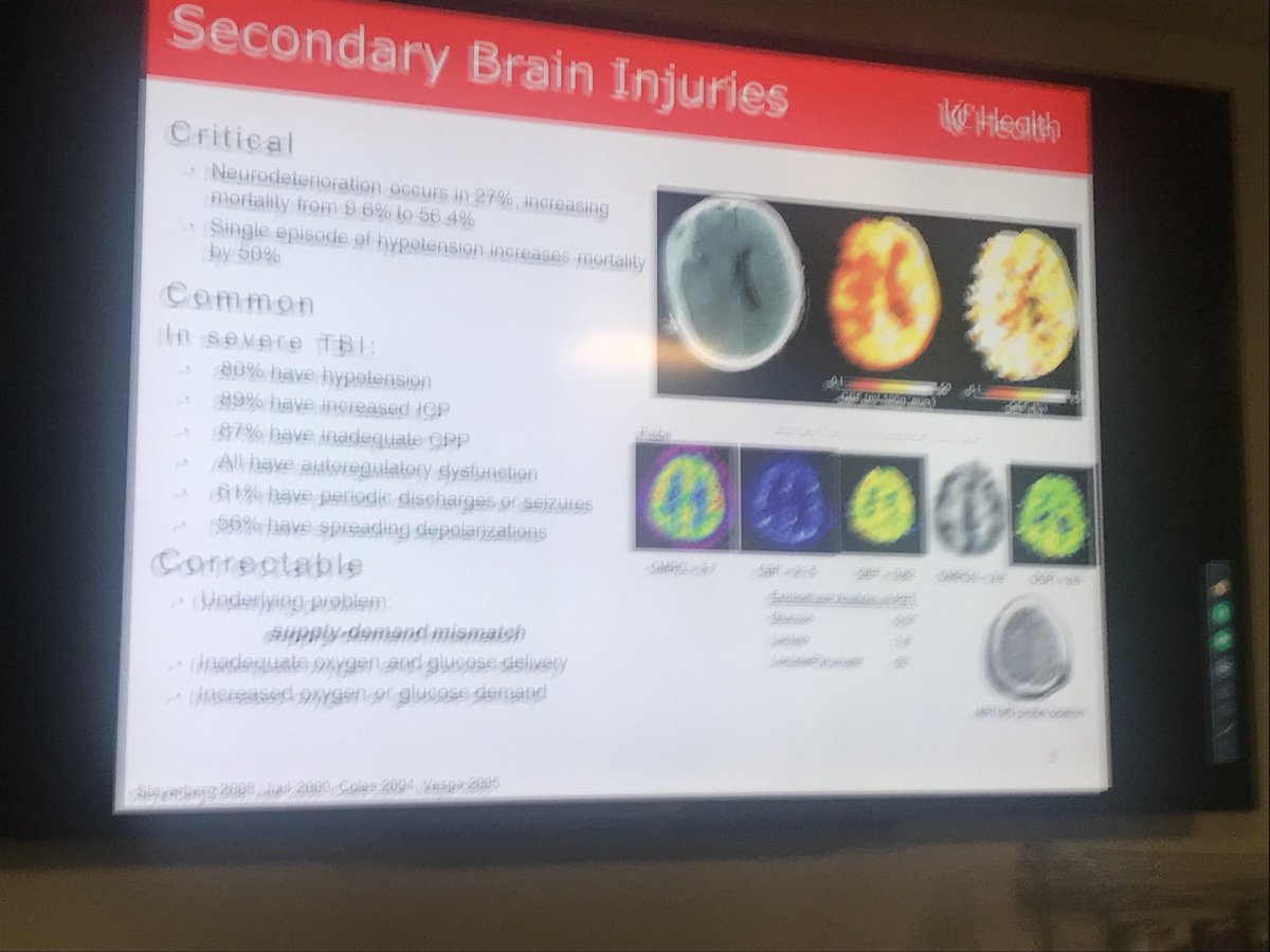 drdangayach's tweet image. @UC_CRANI @AlexReynoldsMD @katereillymd @SamZarbiv @cgzammit @MountSinaiNeuro #neurocc #criticalcare #grandrounds @MountSinaiNYC Brand Foreman @NeuroLlama presenting “Neurophysiology after Acute Brain Injury”
