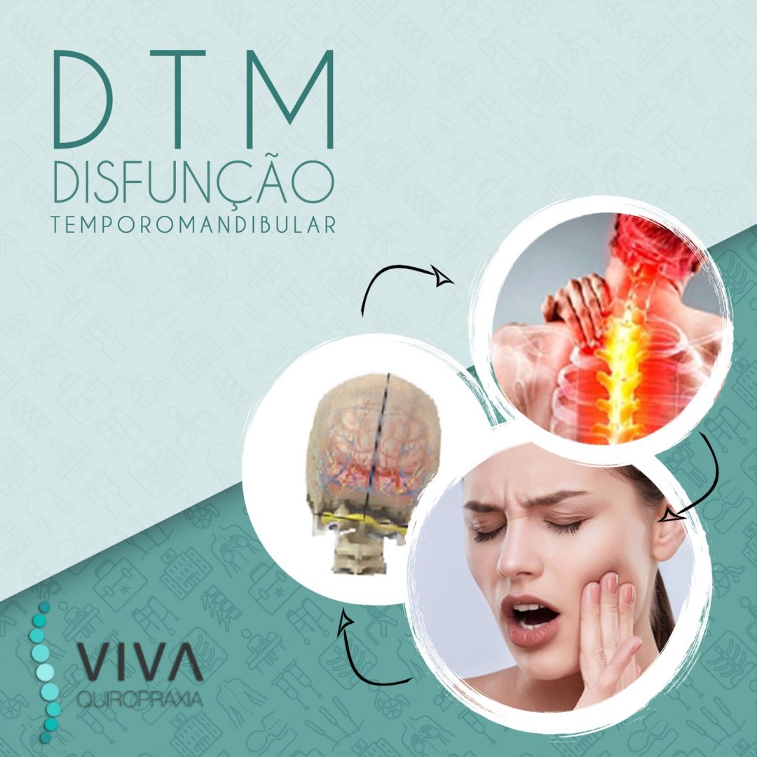O que é Disfunção Temporomandibular (DTM)?