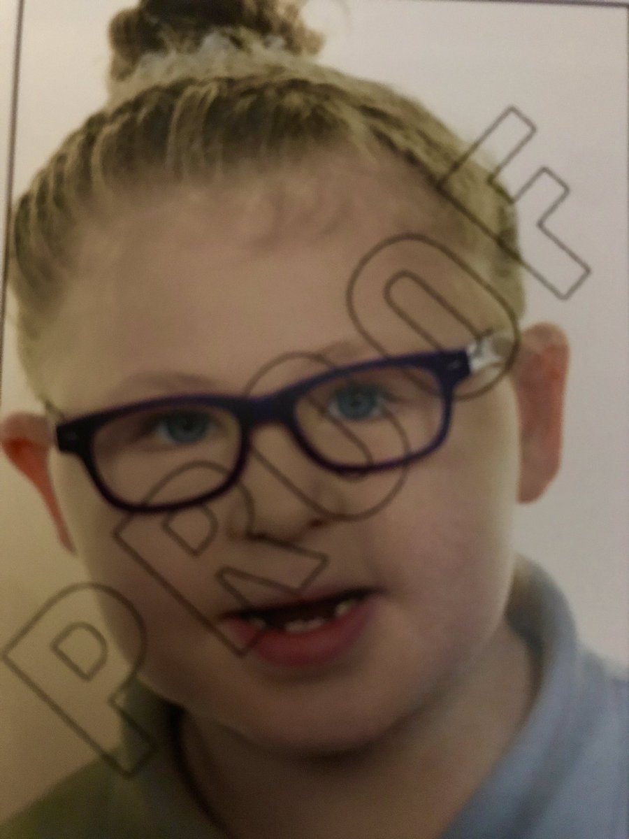 Just beautiful simply beautiful #adhd #microcephaly #AutismAwareness #SEN #adhd