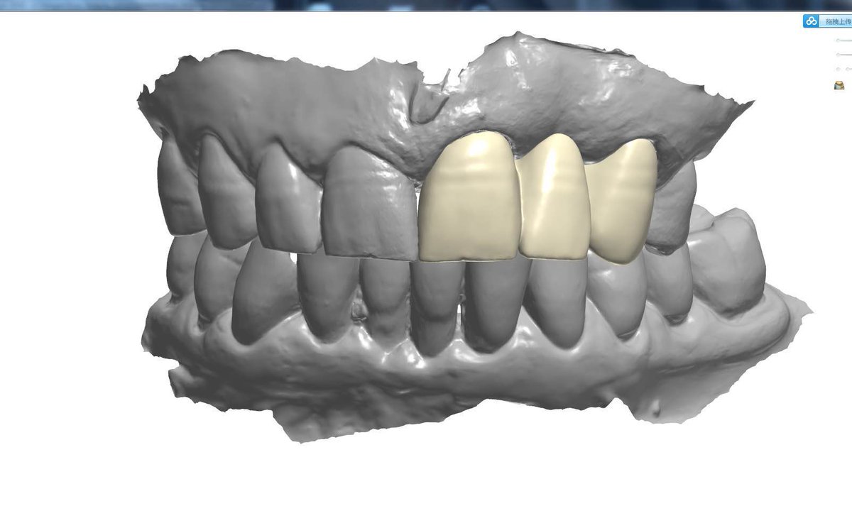 I design full contour Zir crown and bridge on oral scan files. I have designed for many companies in foreign country to build up from 0 to 500 units per month. 5USD each unit for design. If you are interested in it, I can send you photo or files of cases we did. Thank you!
