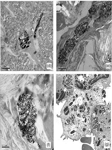 ubcmsl's tweet photo. New research from the #TurnerLabUBC and @UBCChem identified the origin and composition of black deposits in the lung of the 250 y.o. remains of the Kwädąy Dän Ts'ìnchį man.
https://t.co/CMjfMZosCA https://t.co/Epac50jou9