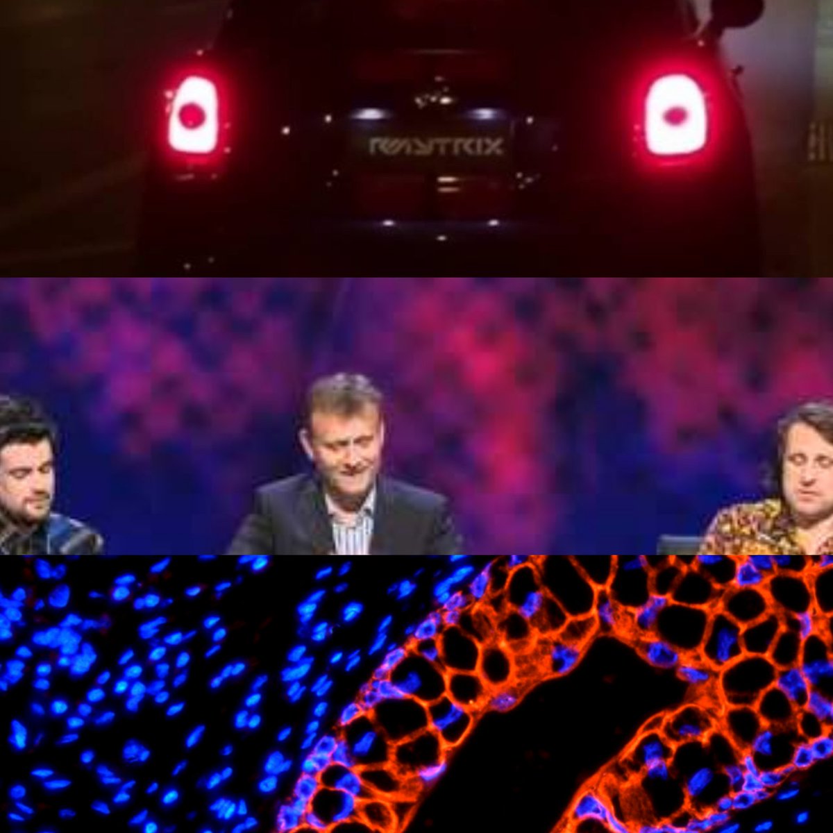 paulbarber3's tweet photo. I've done too much analysis of tissue immunofluorescence this week! It's now everywhere I look. #leaveworkatwork https://t.co/kacaKoz3ZR