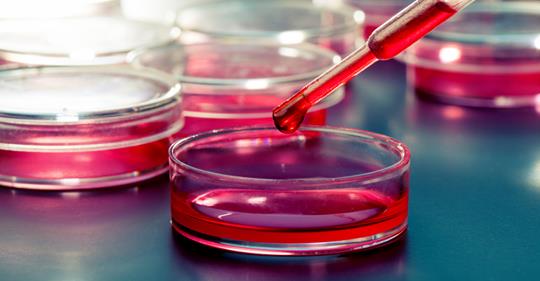 neuroscience_19's tweet photo. #CellStudy shows #Nicotine may protect the #Brain from #Toxic Trace #Metals Linked to #Parkinsons
Researchers showcase your new innovations and work in Parkinson's 2019
Submit your abstract in https://t.co/jCBm0j38L2
@PDpartner @DFB_Team_EN @InteNeuroSci @SAGENeuro @alliedmeet https://t.co/WtDj86BFeA