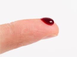 ClinExpPathol's tweet image. It may feel like collectors take a lot of blood when you have a blood test, don’t worry, 15 million blood cells are produced and destroyed in the human body every second!