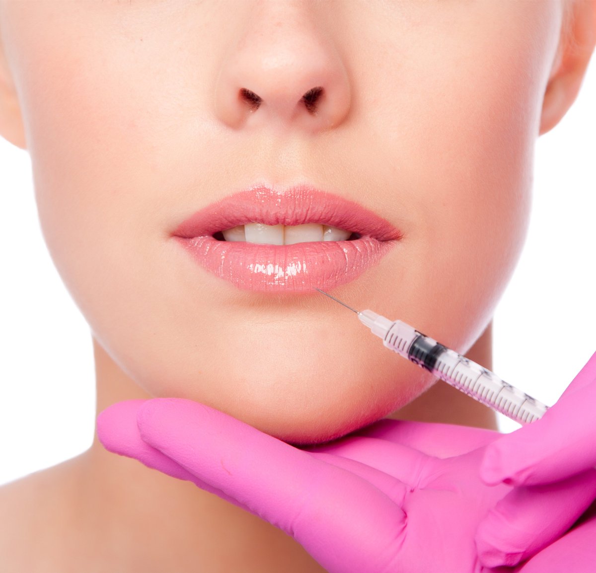 Luxe_Skin's tweet photo. Embrace your own vision of the beauty of plump lips 👄
.
You can be your own kind of beautiful, subtle or dramatic or anywhere in between— so do as you please and feel confident in your own skin. 
💎
#lipfiller #cosmeticsurgery #cosmeticsurgeon #beauty #transformation #lips https://t.co/2RihYAo2GN