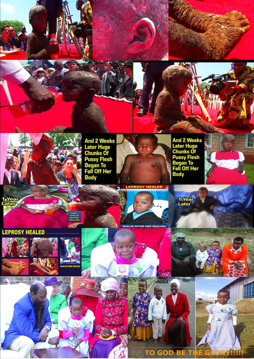 SomeOneTellAbrahamMutai please Don't be bitter with GOD, BTW How is your  daughter now? THE LORD CAN HEAL HER FOR FREE like baby Blessings, baby  Sharlin who was a total cripple and covered