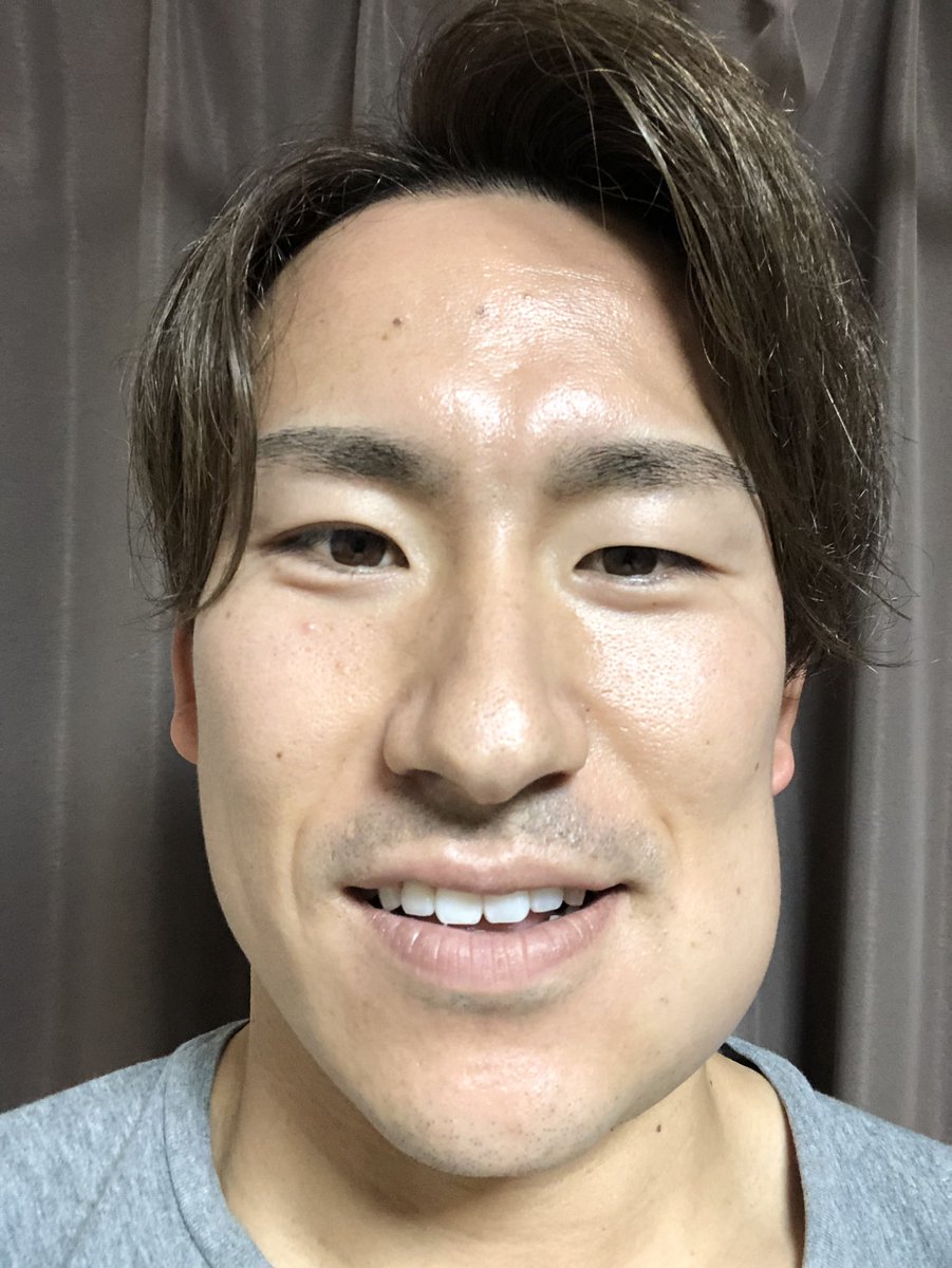 登里 享平 Ar Twitter 親知らず抜いたよー 顔でかくなったよー 登里 享平 Ar Twitter 親知らず抜いたよー 顔でかくなったよー