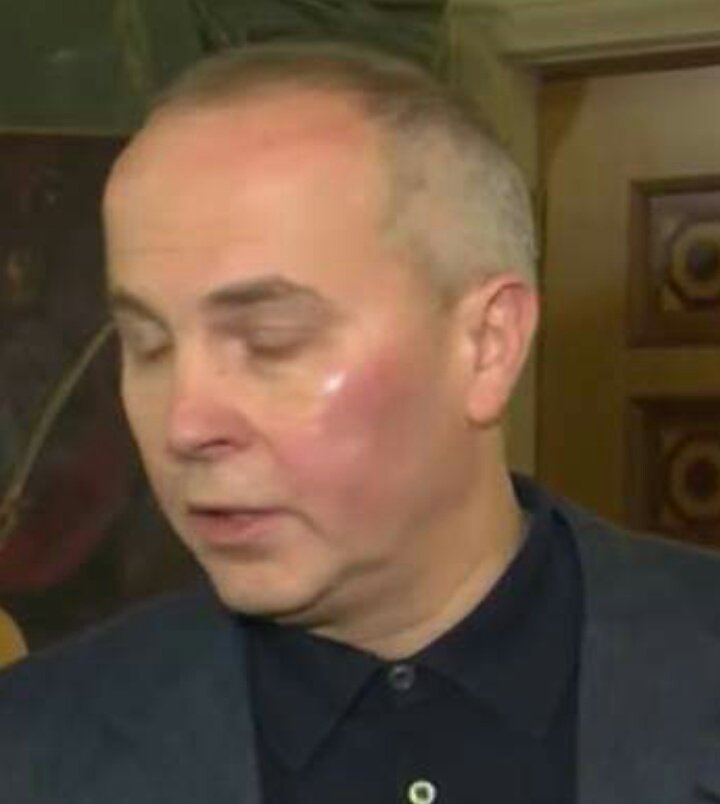 nusss1nn's tweet image. Коли троха приспав ліву частину хлібала.