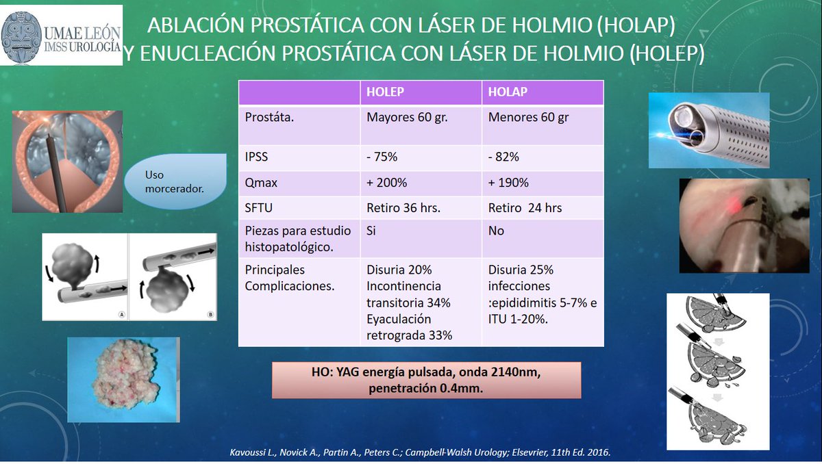 campomanesI's tweet photo. #Próstata #HOLEP #HOLAP https://t.co/jL3StUlvMr