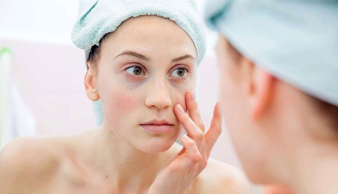 sofvass's tweet image. Μαύροι κύκλοι στα μάτια: Αίτια, φυσική αντιμετώπιση και μακιγιάζ - forlady.gr/%ce%bc%ce%b1%c…