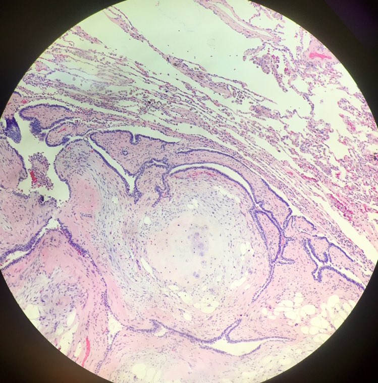 💗  little surprises 💗 #lungpath