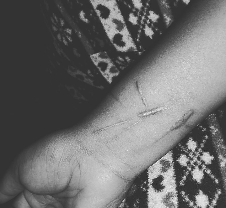 Lewis2ash's tweet photo. 2018 was the worst year of my life but I made it (I-tried-but-I-Survived) #suicide #SuicideAwareness #2018In5Words https://t.co/hkFWcvCBXg