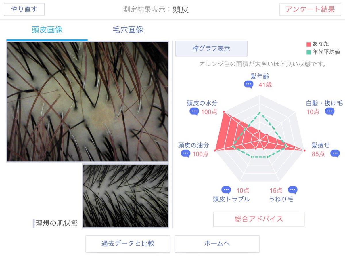 笹本真理子 レチノールフリーでエイジングケアに挑む Ifsccで受賞したミルボンさんの研究 頭皮の状態から未来の髪を予測する 私も診てもらいました 頭皮が赤いですぅ 白髪リスクが高い とのこと 髪年齢４１歳 実年齢38 27から 白髪っ子だからな