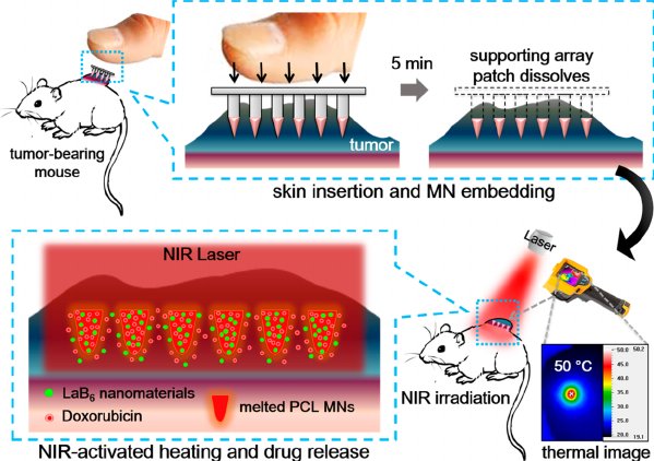 Array in java. Массив строк java. Массив в массиве джава. Supports array. Заполнение строкового массива java.