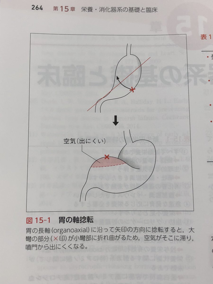 Dr リノ 吐きやすい赤ちゃん 赤ちゃん 特に新生児 を育てていると たくさん吐くことに不安を覚える親御さんは多いと思います 幼少児は 咽頭の機能が未熟で息を止めて液体だけを飲み込めない 空気を一緒に飲み込む 通常は3歳くらい 胃が