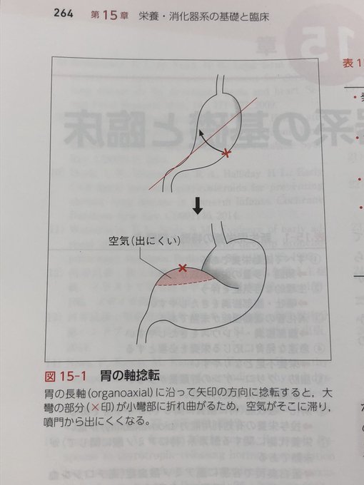 赤ちゃんが元気で体重増加も問題ない場合、大抵は生理的な嘔吐で心配いりません。 Togetter