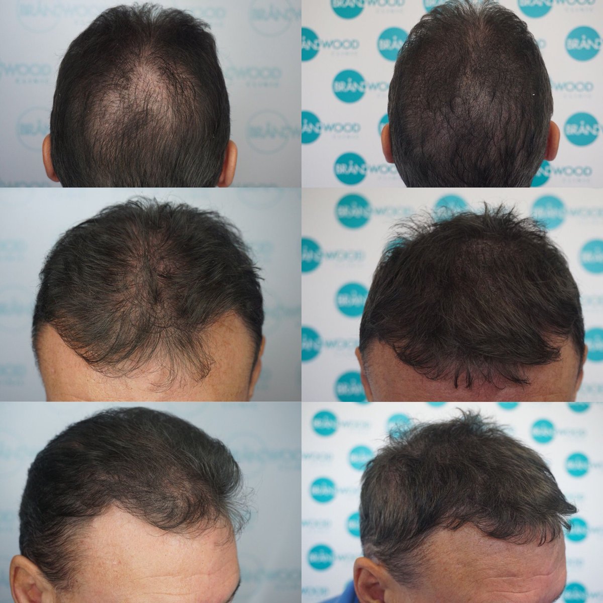 Brandwood Clinic on Twitter: Brandwood Clinic on Twitter: