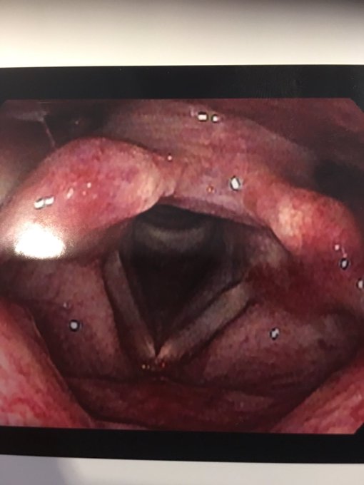 喉の調子が悪いので超美麗3Dで喉を取って貰ったんだけどグロいんだかエロいんだかわからないスクショ撮れました 