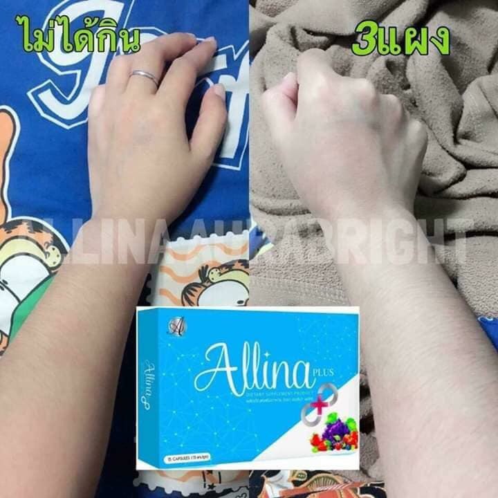 ArgDang's tweet image. 🌟โพสนี้สำหรับคนที่รักตัวเอง  😱😱 
#ทานมาเยอะไม่เห็นผล เปิดใจลอง 
ของดีไม่จำเป็นต้องราคาแพง ‼️‼️

วันละ 2 เม็ด ได้ทั้ง ตัว แขน ขา ใสมากกกกก
จนใครเห็นก็ต้องทัก ใครๆก็ชอบให้ตัวเองดูดี 
➡1กล่อง290บาท 
➡2กล่องส่งฟรี🔥🔥🔥