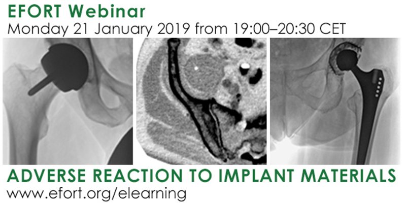 #Free #registration for EFORT #webinar on Adverse Reaction to #Implant Materials on 21 January ➡️efortnet.conference2web.com/#!courses
#EOTEP #events #orthopaedics #trauma #surgery #elearning #surgeon #education #implant #tribology #biology #genetic #infection #hip #kne #TKA #THA #arthroplasty