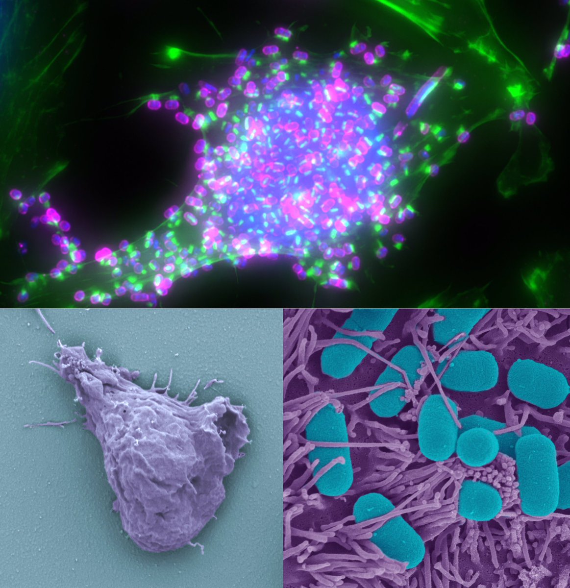 Brain eating amoeba and EHEC and EPEC, oh my! Learn how actin drives the pathogenesis of these microbes at my postdoc/PhD mashup poster, B 106 today from 1:30-3:30. #ASCBEMBO18