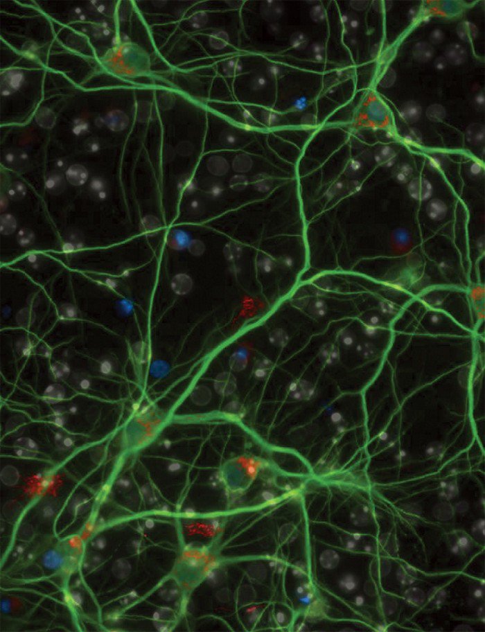 cenmag's tweet image. Two teams of researchers have independently converged on a new drug target for #Parkinsons #disease. A lipid-desaturating enzyme offers a strategy that is totally different from any other intervention ever attempted for Parkinson’s disease. ow.ly/JVg430mWEAS