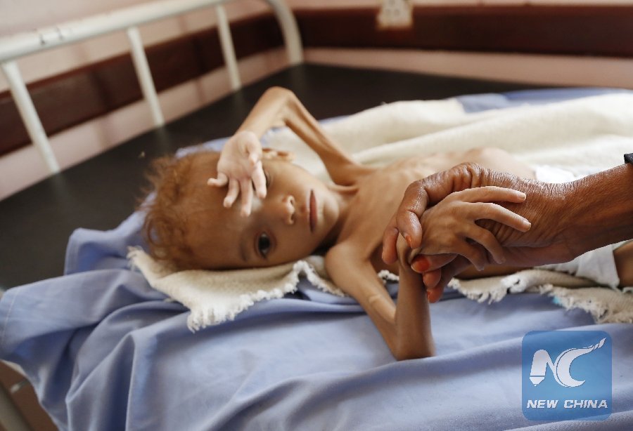 The UN humanitarian chief said Monday that Yemen now has 42 percent more areas where people suffer severe #food insecurity compared with figures from last year.