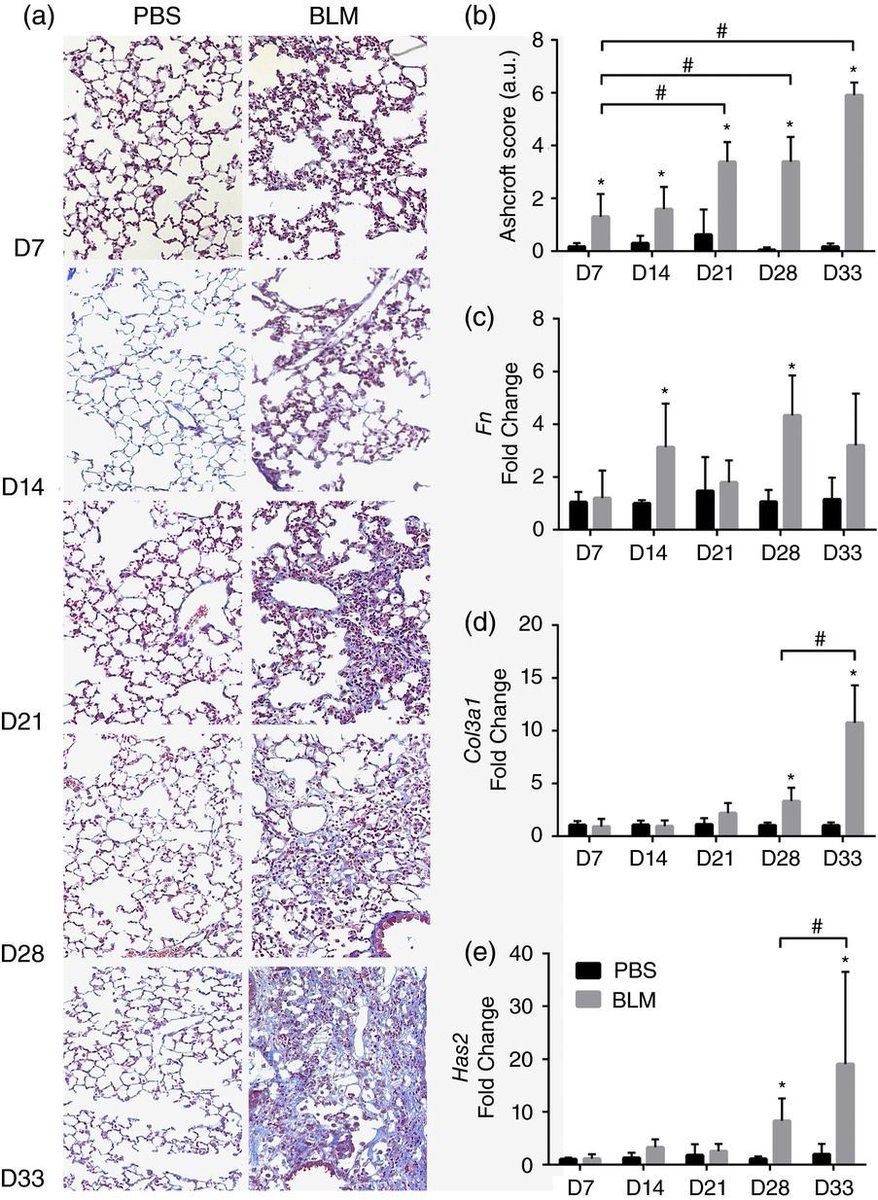 Low dose administration of bleomycin leads to early alterations in lung mechanics <a href="/UTHealth/">UTHealth</a> buff.ly/2Q5XdIs