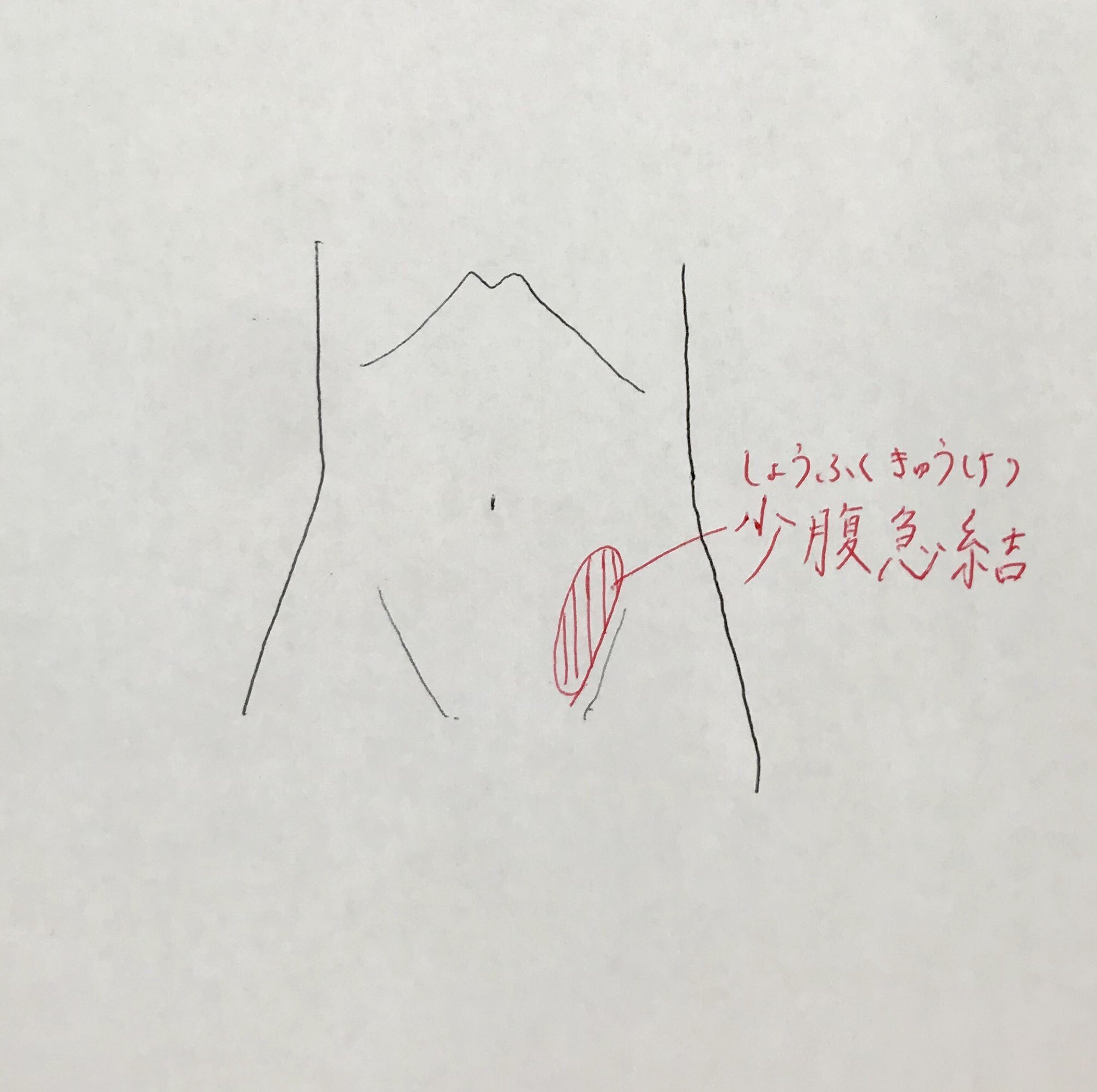 Coco美漢方 田中 友也です 体を触って自分を知ろう 左足の付け根 イラスト辺りの下腹部を押すと嫌な感じや痛みのある方は 瘀血 血液ドロドロ があるサインです 頭痛や肩こり 手足の冷え 生理痛 シミやソバカスが多い 顔色がくすんでいる