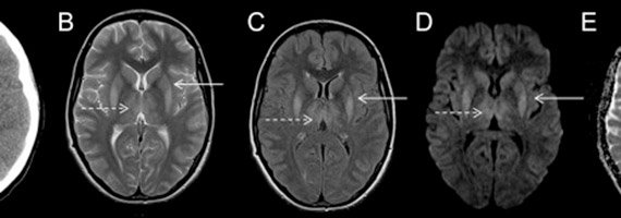 British Journal Of Anaesthesia On Twitter What Are The - 