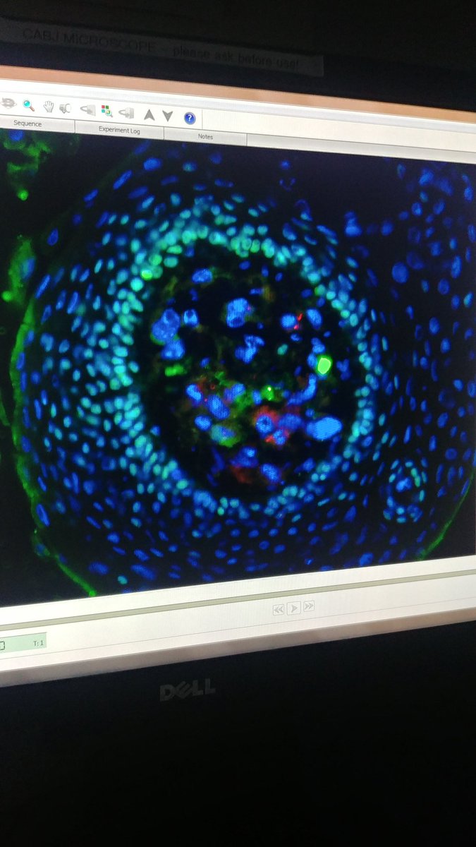 MelissaEJackson's tweet image. When u take a punt on a trial antibody because ur desperate to get p63 to show up and u have spent 2 years tryna get it to work and the new @abcam antibody works straight away I'm so happy I wanna cry thank u