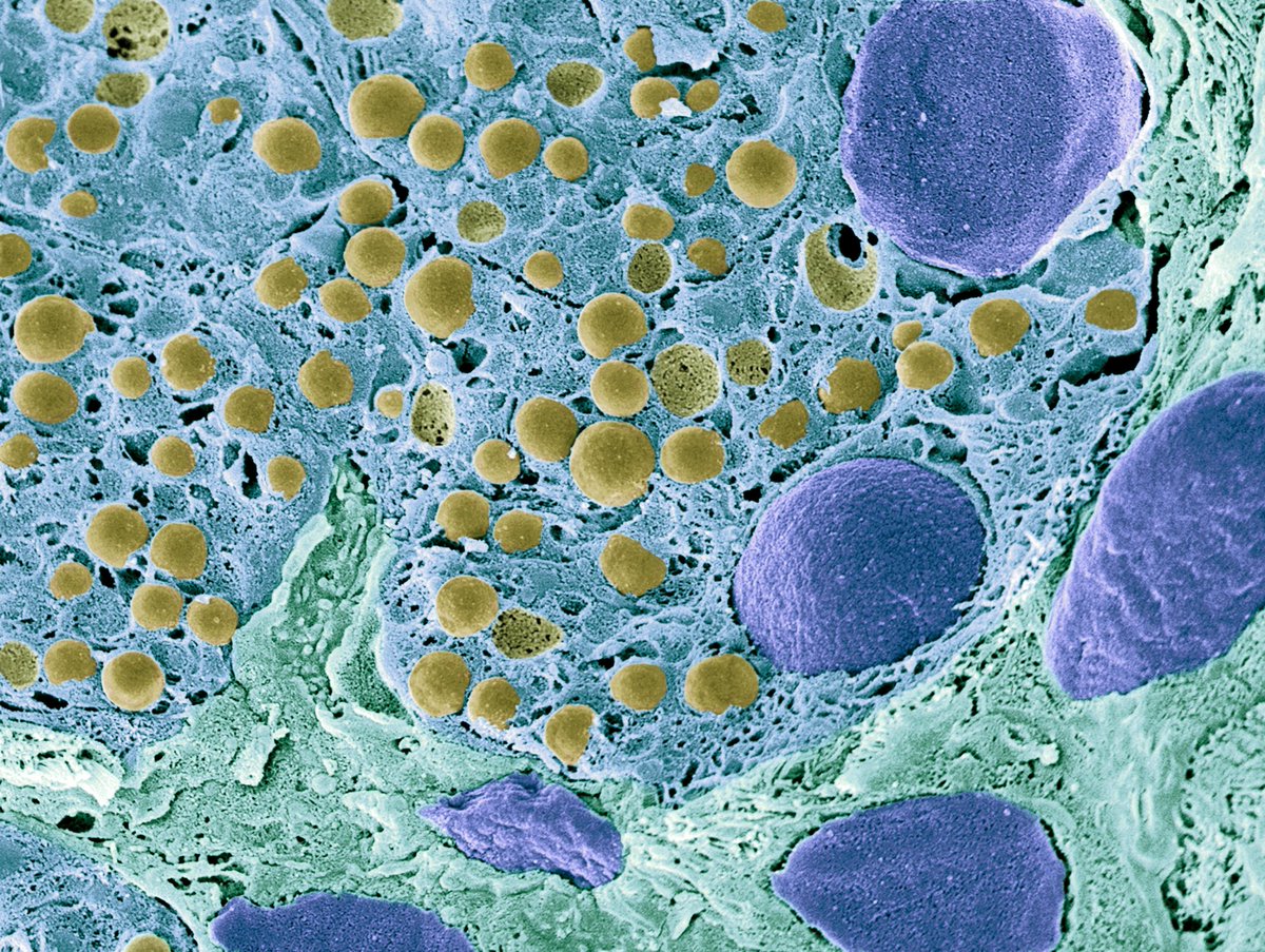CZI Science (@cziscience) on Twitter photo CZI milestone from 2018: We launched an open call for grants with <a href="/HelmsleyTrust/">Helmsley Charitable Trust</a> to support groups of scientists around the world to help map the human body for the <a href="/humancellatlas/">Human Cell Atlas</a>. Learn more: chanzuckerberg.com/about/annual-l… CZI milestone from 2018: We launched an open call for grants with <a href="/HelmsleyTrust/">Helmsley Charitable Trust</a> to support groups of scientists around the world to help map the human body for the <a href="/humancellatlas/">Human Cell Atlas</a>. Learn more: chanzuckerberg.com/about/annual-l…