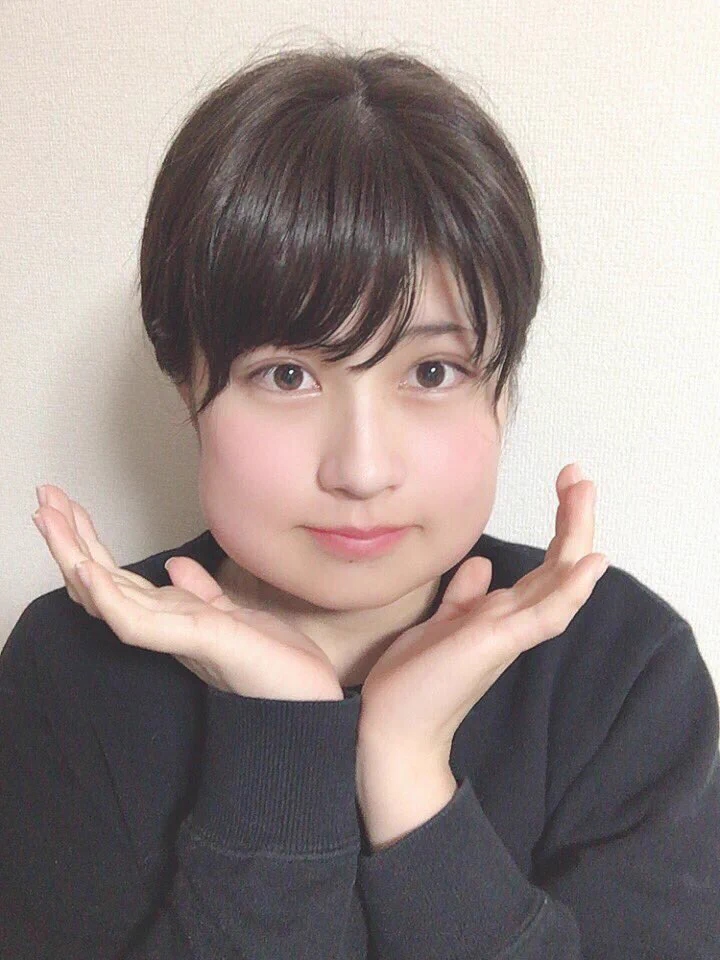 親知らずを抜いたら腫れました！！そんな顔がこちらですｗｗｗ
