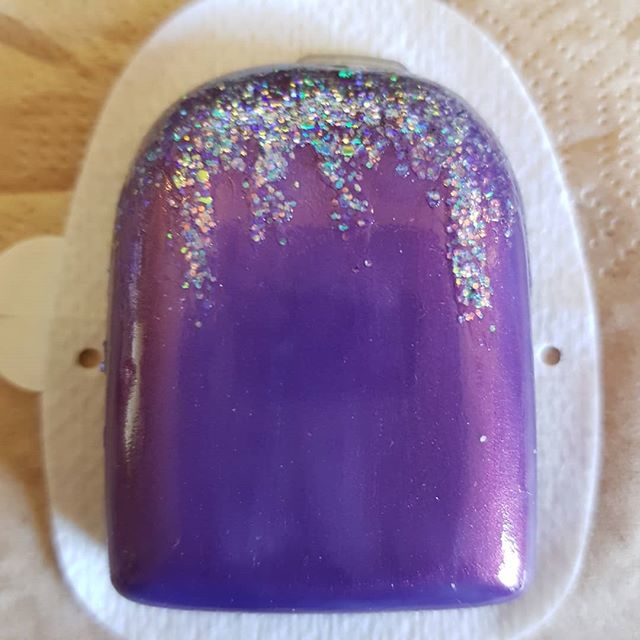 Other_Ryn's tweet image. Finally below freezing in the mornings here in Düsseldorf, so an icy #omnipod is gonna be my arm decoration for the next three days.

Now to figure out a firework motif for the new year!

#pimpmypod #insulinpump #t1d