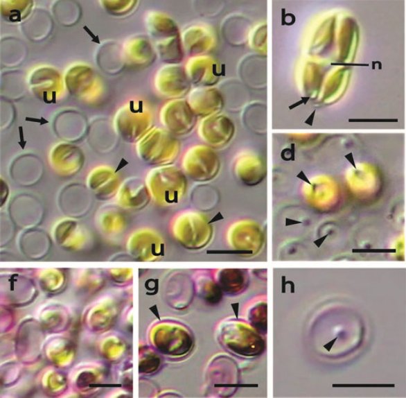 protistologists's tweet image. Chrysoparadoxa australica: The golden paradox – a new heterokont lineage with chloroplasts surrounded by 2 membranes onlinelibrary.wiley.com/doi/10.1111/jp… #protists #algae 

The outer chloroplast membrane is continuous between the two chloroplasts via the outer membrane of the nuclear envelope