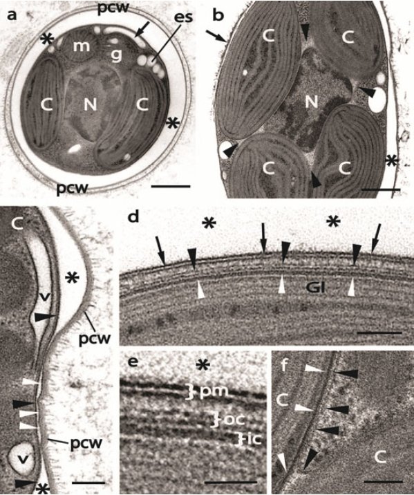 protistologists's tweet image. Chrysoparadoxa australica: The golden paradox – a new heterokont lineage with chloroplasts surrounded by 2 membranes onlinelibrary.wiley.com/doi/10.1111/jp… #protists #algae 

The outer chloroplast membrane is continuous between the two chloroplasts via the outer membrane of the nuclear envelope