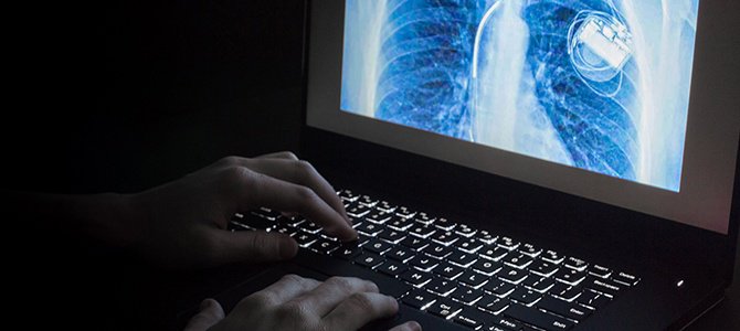 As medical #technology becomes more sophisticated, the potential for malicious #cyberhacking of medical devices has become real. ow.ly/WB9f30mW752